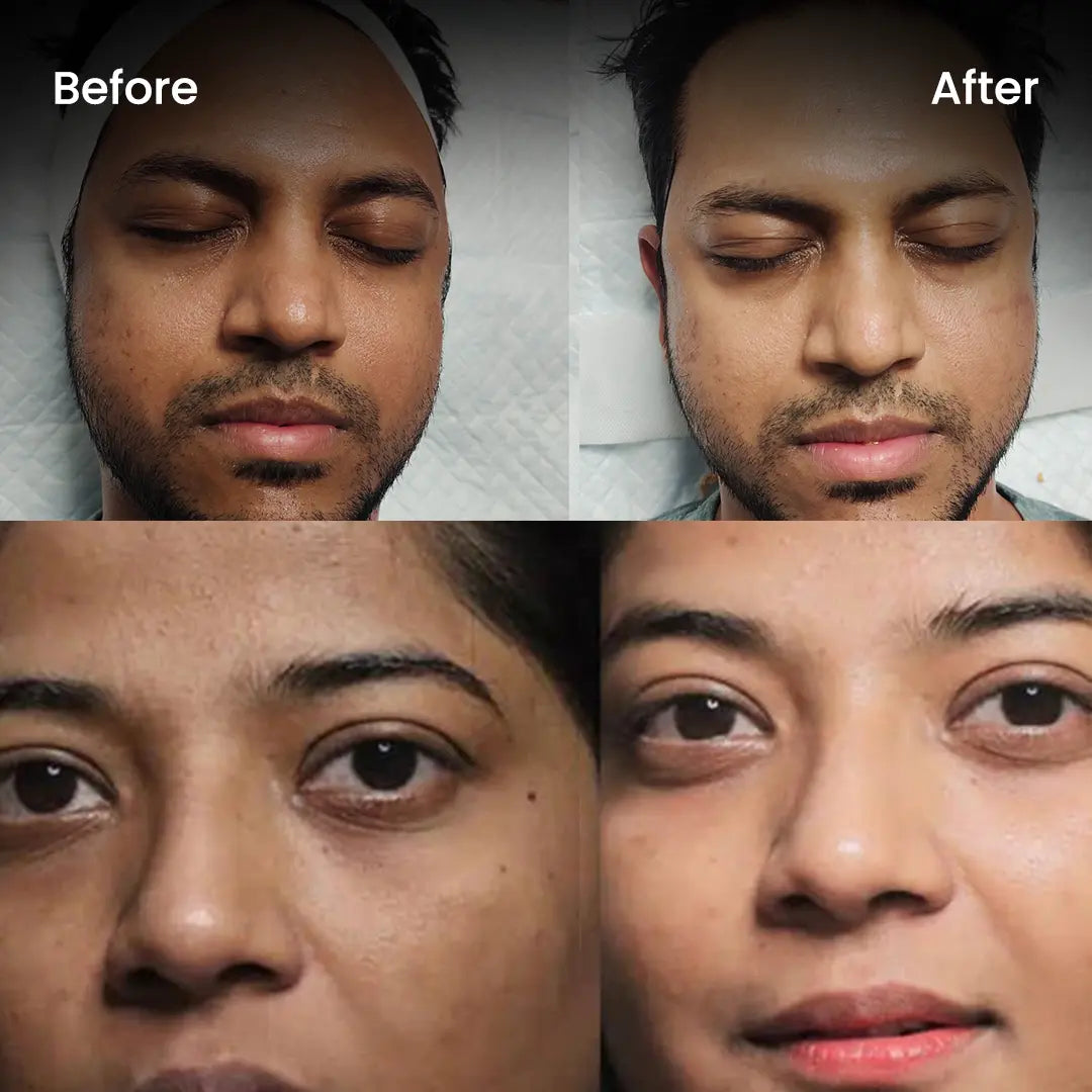 Glowasy Tan Vanish Gluta-Kojic Skin Polish